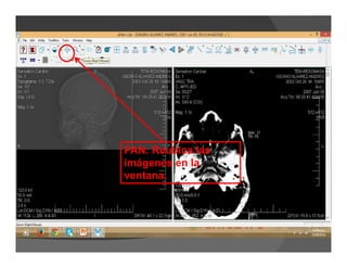 PAN: Reubica las
imágenes en la
ventana.
 