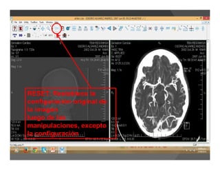 RESET: Restablece la
configuración original de
la imagen
luego de las
manipulaciones, excepto
la configuración
 