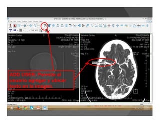 ADD USER: Permite al
usuario agregar y ubicar
texto en la imagen.
 