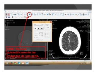 CINE: Recorre
automáticamente las
imágenes de una serie.
 