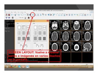 SCREEN LAYOUT: Vuelve a mostrar
series e imágenes en varios diseños
en la pantalla.
 