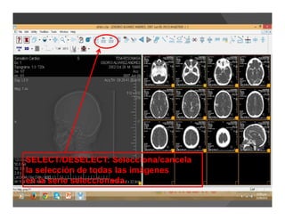 SELECT/DESELECT: Selecciona/cancela
la selección de todas las imágenes
en la serie seleccionada.
 