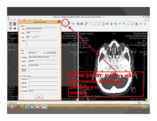 SHOW STUDY: Muestra más
información acerca del
paciente y el
estudio.
 