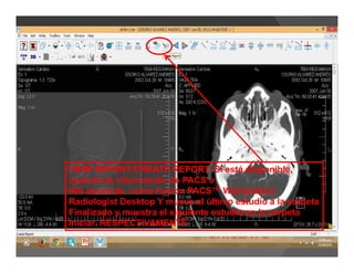 VIEW REPORT/CREATE REPORT: Si está disponible,
muestra la información de PACS o
RIS asociada, como Fusion PACS™ Workstation
Radiologist Desktop Y mueve el último estudio a la carpeta
Finalizado y muestra el siguiente estudio en la carpeta
Iniciar. RESPECTIVAMENTE
 