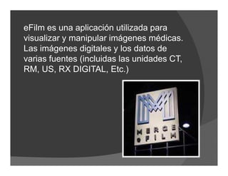 eFilm es una aplicación utilizada para
visualizar y manipular imágenes médicas.
Las imágenes digitales y los datos de
varias fuentes (incluidas las unidades CT,
RM, US, RX DIGITAL, Etc.)
 