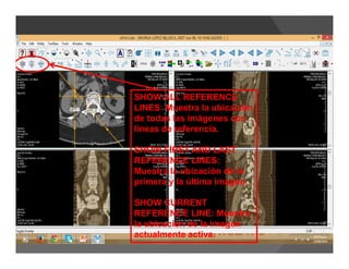SHOW ALL REFERENCE
LINES: Muestra la ubicación
de todas las imágenes con
líneas de referencia.
SHOW FIRST AND LAST
REFERENCE LINES:
Muestra la ubicación de la
primera y la última imagen.
SHOW CURRENT
REFERENCE LINE: Muestra
la ubicación de la imagen
actualmente activa.
 