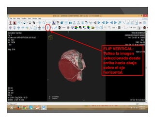 FLIP VERTICAL:
Voltea la imagen
seleccionada desde
arriba hacia abajo
sobre el eje
horizontal.
 
