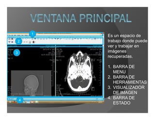 2
4
3
1
Es un espacio de
trabajo donde puede
ver y trabajar en
imágenes
recuperadas.
1. BARRA DE
MENU
2. BARRA DE
HERRAMIENTAS
3. VISUALIZADOR
DE IMAGEN
4. BARRA DE
ESTADO
 