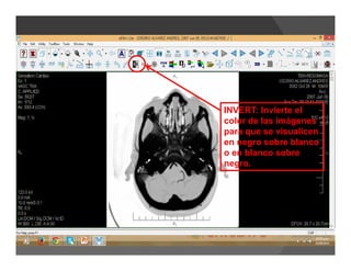 INVERT: Invierte el
color de las imágenes
para que se visualicen
en negro sobre blanco
o en blanco sobre
negro.
 