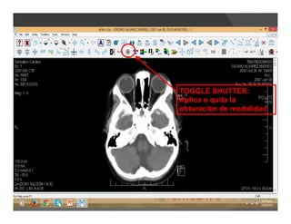 TOGGLE SHUTTER:
Aplica o quita la
obturación de modalidad.
 