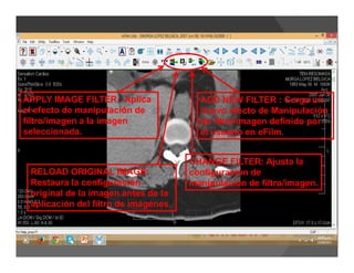 ADD NEW FILTER : Carga un
nuevo efecto de Manipulación
de filtro/imagen definido por
el usuario en eFilm.
CHANGE FILTER: Ajusta la
configuración de
manipulación de filtro/imagen.
RELOAD ORIGINAL IMAGE:
Restaura la configuración
original de la imagen antes de la
aplicación del filtro de imágenes.
APPLY IMAGE FILTER : Aplica
el efecto de manipulación de
filtro/imagen a la imagen
seleccionada.
 