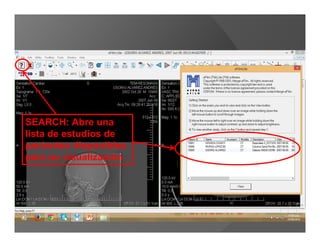 SEARCH: Abre una
lista de estudios de
pacientes disponibles
para su visualización.
 
