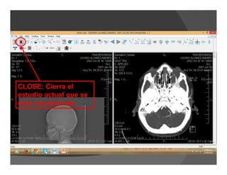 CLOSE: Cierra el
estudio actual que se
está visualizando.
 