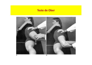 Teste de Ober
 