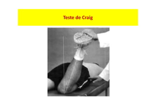 Teste de Craig
 