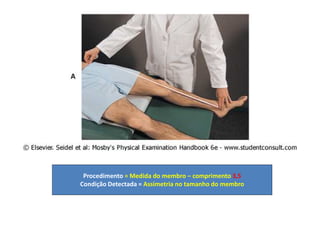 Procedimento = Medida do membro – comprimento 3,5
Condição Detectada = Assimetria no tamanho do membro
 