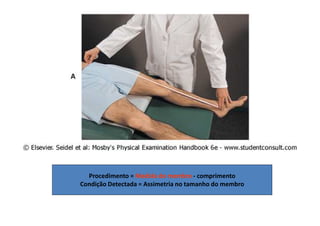 Procedimento = Medida do membro - comprimento
Condição Detectada = Assimetria no tamanho do membro
 