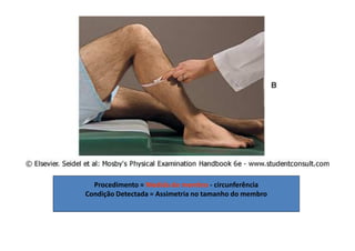 Procedimento = Medida do membro - circunferência
Condição Detectada = Assimetria no tamanho do membro
 