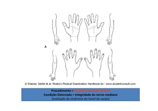 Procedimento = Diagrama de mão de Katz
Condição Detectada = Integridade do nervo mediano
(avaliação da síndrome do túnel do carpo)
 