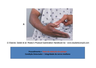 Procedimento = Teste da abdução do polegar
Condição Detectada = integridade do nervo mediano
 