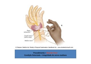 Procedimento = Sinal de Tinel
Condição Detectada = Integridade do nervo mediano
 