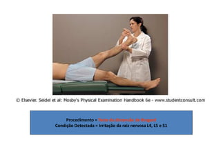 Procedimento = Teste da distensão de Bragard
Condição Detectada = Irritação da raiz nervosa L4, L5 e S1
 