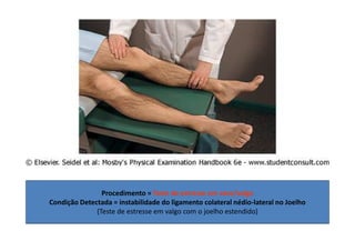 Procedimento = Teste de estresse em varo/valgo
Condição Detectada = instabilidade do ligamento colateral nédio-lateral no Joelho
(Teste de estresse em valgo com o joelho estendido)
 