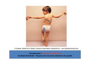 Procedimento = Sinal de Trendelenburg
Condição Detectada = fraqueza dos músculos abdutores do quadril.
 