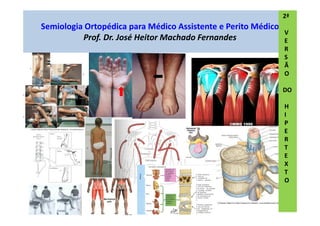 Semiologia Ortopédica para Médico Assistente e Perito Médico
Prof. Dr. José Heitor Machado Fernandes
2ª
V
E
R
S
Ã
O
DO
H
I
P
E
R
T
E
X
T
O
 
