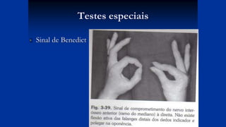 Testes especiais
 Sinal de Benedict
 
