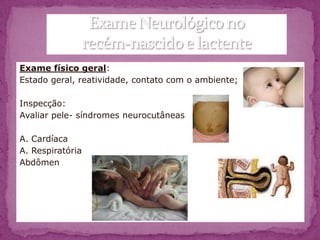 Exame físico geral:
Estado geral, reatividade, contato com o ambiente;

Inspecção:
Avaliar pele- síndromes neurocutâneas

A. Cardíaca
A. Respiratória
Abdômen
 
