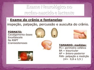  Exame do crânio e fontanelas:
inspeção, palpação, percussão e ausculta do crânio.

FORMATO:
Cavalgamento ósseo
Encefalocele
No RNPT
Cranioestenoses
                                TAMANHO- medidas:
                                PC= perímetro cefálico
                                BA = biauricular
                                AP = ântero-posterior
                                FAN- palpação e medição
                                   (nl= 0,8 a 3,5 )
 