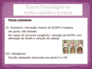  Pares cranianos:


XI- Acessório: inervação motora do ECOM e trapézio
  em geral, não testado
  Em casos de torcicolo congênito: retração do ECOM, com
  alteração da flexão e rotação da cabeça




XII- Hipoglosso:
  Sucção adequada associada aos pares V e VII
 