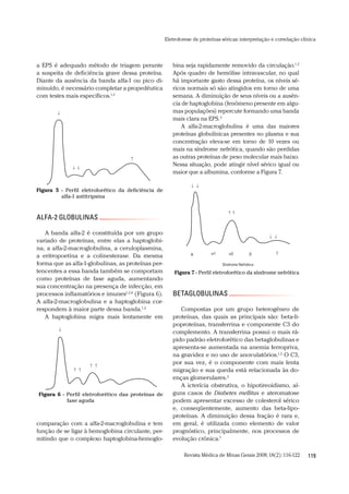 Revista Médica de Minas Gerais 2008;18(2):116-122 119
Eletroforese de proteínas séricas:interpretação e correlação clínica
bina seja rapidamente removido da circulação.1,2
Após quadro de hemólise intravascular, no qual
há importante gasto dessa proteína, os níveis sé-
ricos normais só são atingidos em torno de uma
semana. A diminuição de seus níveis ou a ausên-
cia de haptoglobina (fenômeno presente em algu-
mas populações) repercute formando uma banda
mais clara na EPS.2
A alfa-2-macroglobulina é uma das maiores
proteínas globulínicas presentes no plasma e sua
concentração eleva-se em torno de 10 vezes ou
mais na síndrome nefrótica, quando são perdidas
as outras proteínas de peso molecular mais baixo.
Nessa situação, pode atingir nível sérico igual ou
maior que a albumina, conforme a Figura 7.
BETAGLOBULINAS
Compostas por um grupo heterogêneo de
proteínas, das quais as principais são: beta-li-
poproteínas, transferrina e componente C3 do
complemento. A transferrina possui o mais rá-
pido padrão eletroforético das betaglobulinas e
apresenta-se aumentada na anemia ferropriva,
na gravidez e no uso de anovulatórios.1,2
O C3,
por sua vez, é o componente com mais lenta
migração e sua queda está relacionada às do-
enças glomerulares.2
A icterícia obstrutiva, o hipotireoidismo, al-
guns casos de Diabetes mellitus e ateromatose
podem apresentar excesso de colesterol sérico
e, conseqüentemente, aumento das beta-lipo-
proteínas. A diminuição dessa fração é rara e,
em geral, é utilizada como elemento de valor
prognóstico, principalmente, nos processos de
evolução crônica.7
a EPS é adequado método de triagem perante
a suspeita de deficiência grave dessa proteína.
Diante da ausência da banda alfa-1 ou pico di-
minuído, é necessário completar a propedêutica
com testes mais específicos.1,2
ALFA-2 GLOBULINAS
A banda alfa-2 é constituída por um grupo
variado de proteínas, entre elas a haptoglobi-
na, a alfa-2-macroglobulina, a ceruloplasmina,
a eritropoetina e a colinesterase. Da mesma
forma que as alfa-1-globulinas, as proteínas per-
tencentes a essa banda também se comportam
como proteínas de fase aguda, aumentando
sua concentração na presença de infecção, em
processos inflamatórios e imunes1,2,6
(Figura 6).
A alfa-2-macroglobulina e a haptoglobina cor-
respondem à maior parte dessa banda.1,2
A haptoglobina migra mais lentamente em
comparação com a alfa-2-macroglobulina e tem
função de se ligar à hemoglobina circulante, per-
mitindo que o complexo haptoglobina-hemoglo-
Figura 5 - Perfil eletroforético da deficiência de
alfa-1 antitripsina
Figura 6 - Perfil eletroforético das proteínas de
fase aguda
Síndrome Nefrótica
1 2A
Figura 7 - Perfil eletroforético da síndrome nefrótica
 