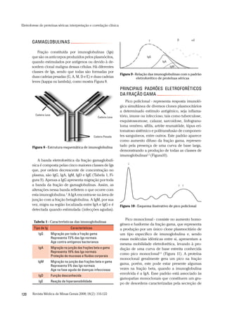 Revista Médica de Minas Gerais 2008;18(2):116-122120
Eletroforese de proteínas séricas:interpretação e correlação clínica
PRINCIPAIS PADRÕES ELETROFORÉTICOS
DA FRAÇÃO GAMA
Pico policlonal - representa resposta imunoló-
gica simultânea de diversos clones plasmocitários
a determinado estímulo antigênico, seja inflama-
tório, imune ou infeccioso, tais como tuberculose,
esquistossomose, calazar, sarcoidose, linfogranu-
loma venéreo, sífilis, artrite reumatóide, lúpus eri-
tomatoso sistêmico e politransfusão de componen-
tes sanguíneos, entre outros. Este padrão aparece
como aumento difuso da fração gama, represen-
tado pela presença de uma curva de base larga,
demonstrando a produção de todas as classes de
imunoglobulinas1,2
(Figura10).
Pico monoclonal - consiste no aumento homo-
gêneo e fusiforme da fração gama, que representa
a produção por um único clone plasmocitário de
um tipo específico de imunoglobulina e, sendo
essas moléculas idênticas entre si, apresentam a
mesma mobilidade eletroforética, levando à pro-
dução de uma curva de base estreita conhecida
como pico monoclonal1,2
(Figura 11). A proteína
monoclonal geralmente gera um pico na fração
gama, porém, este pode estar presente algumas
vezes na fração beta, quando a imunoglobulina
envolvida é a IgA. Esse padrão está associado às
gamopatias monoclonais que constituem um gru-
po de desordens caracterizadas pela secreção de
GAMAGLOBULINAS
Fração constituída por imunoglobulinas (Igs)
que são os anticorpos produzidos pelos plasmócitos,
quando estimulados por antígenos ou devido à de-
sordem clonal maligna dessas células. Há diferentes
classes de Igs, sendo que todas são formadas por
duas cadeias pesadas (G, A, M, D e E) e duas cadeias
leves (kappa ou lambda), como mostra Figura 8.
A banda eletroforética da fração gamaglobulí-
nica é composta pelas cinco maiores classes de Igs
que, por ordem decrescente de concentração no
plasma, são IgG, IgA, IgM, IgD e IgE (Tabela 1, Fi-
gura 9). Apenas a IgG apresenta migração por toda
a banda da fração de gamaglobulinas. Assim, as
alterações nessa banda refletem o que ocorre com
esta imunoglobulina.2
A IgA encontra-se na área de
junção com a fração betaglobulina. A IgM, por sua
vez, migra na região localizada entre IgA e IgG e é
detectada quando estimulada (infecções agudas).
Tabela 1 - Características das imunoglobulinas
Tipo de Ig Características
IgG Migração por toda a fração gama
Representa 73% das Igs normais
Age contra antígenos bacterianos
IgA Migração na junção das frações beta e gama
Representa 19% das Igs normais
Proteção de mucosas e fluidos corporais
IgM Migração na junção das frações beta e gama
Representa 5% das Igs normais
Age na fase aguda de doenças infecciosas
IgD Função desconhecida
IgE Reação de hipersensibilidade
Figura 8 - Estrutura esquemática de imunoglobulina
Cadeira Leve
Cadeira Leve
Cadeira Pesada
2
IgG
IgA
IgM
Figura 9 - Relação das imunoglobulinas com o padrão
eletroforético de proteínas séricas
Figura 10 - Esquema ilustrativo de pico policlonal
 