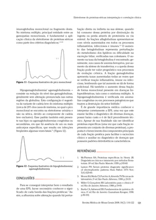 Revista Médica de Minas Gerais 2008;18(2):116-122 121
Eletroforese de proteínas séricas:interpretação e correlação clínica
bação direta ou indireta na sua síntese, quando
há consumo dessa proteína por diminuição da
ingesta ou perda através de proteinúria ou via
enteral. As frações alfaglobulinas apresentam-se
com níveis aumentados em todos os processos
inflamatórios, infecciosos e imunes.1,2
O aumen-
to das betaglobulinas representa perturbação
do metabolismo dos lipídeos ou dificuldade na
excreção biliar, verificadas nas colestases. O au-
mento na taxa da betaglobulina é encontrado, ge-
ralmente, nos casos de anemia ferropriva, por au-
mento da síntese de transferrina; e a queda dessa
fração pode ter valor prognóstico nos processos
de evolução crônica. A fração gamaglobulina
apresenta taxas aumentadas todas as vezes que
se verificar reação inflamatória, imune ou infec-
ciosa, lembrando que tal aumento se dá de forma
policlonal. Há também o aumento dessa fração
de forma monoclonal presente em doenças lin-
foproliferativas, tais como o mieloma múltiplo. A
hipogamaglobulinemia é verificada em anoma-
lias congênitas ou em processos patogênicos que
trazem a destruição do setor linfóide.7
É de grande importância médica conhecer e
interpretar corretamente a EPS, uma vez que este
exame facilita o diagnóstico de diversas doenças,
possui baixo custo e é de fácil procedimento téc-
nico. Apesar de sua finalidade não ser identificar
proteínas específicas (uma vez que cada fração re-
presenta um conjunto de diversas proteínas), a pro-
posta é o fornecimento dos componentes principais
de cada fração protéica para facilitar o raciocínio
clínico e auxiliar no diagnóstico de doenças que
possuem padrões eletroforéticos característicos.
REFERÊNCIAS
McPherson RA. Proteínas específicas. ln: Henry JB.1.
Diagnósticos cínicos e tatamento por métodos lbora-
toriais.18a
ed.São Paulo:Manole;1999.p.245-60.
Larson PH. Serum proteins: diagnostic significance2.
of electrophoretic patterns. Hum Pathol. 1974 Nov;
5(6):629-40.
Moura RA,Wada CS,PurchioA,AlmeidaTV.Técnicas de3.
laboratório.3a
ed.São Paulo:Atheneu;1998.p.23-33.
Miller O,Gonçalves RR.Laboratório para o clínico.64. a
ed.Rio de Janeiro:Atheneu;1988.p.19-49.
Burtis CA,Ashwood ER.Fundamentos de química clí-5.
nica. 4a
ed. Rio de Janeiro: Guanabara Koogan; 1998.
p.96-102.
imunoglobulina monoclonal ou fragmento desta.
No mieloma múltiplo, principal entidade entre as
gamopatias monoclonais, é fundamental a apli-
cação clínica da eletroforese de proteínas séricas
como parte dos critérios diagnósticos.1, 8-10
Hipogamaglobulinemia/ agamaglobulinemia –
consiste na redução do nível das gamaglobulinas,
geralmente sem alteração pronunciada nas outras
regiões da globulina. Esta configuração é sugesti-
va da variante de cadeia leve do mieloma múltiplo
(cerca de 20% dos casos de mieloma, no qual o pico
monoclonal se encontra na eletroforese urinária e
não na sérica, devido ao componente de cadeia
leve exclusivo). Esse padrão também está presen-
te nas hipo ou agamaglobulinemias congênitas ou
secundárias, em que há ausência de um ou mais
anticorpos específicos, que resulta em infecções
freqüentes algumas vezes fatais.11
(Figura 12).
CONCLUSÕES
Para se conseguir interpretar bem o resultado
de uma EPS, faz-se necessário conhecer o signi-
ficado de cada banda das frações protéicas.1
As-
sim, a albumina sofre alteração quando há pertur-
Figura 11 - Esquema ilustrativo de pico monoclonal
Figura 12 - Esquema ilustrativo de hipoglobulinemia/
agamaglobulinemia
 