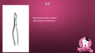 Remanescentes (restos
radiculares) inferiores
 