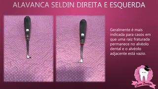 Geralmente é mais
indicada para casos em
que uma raiz fraturada
permanece no alvéolo
dental e o alvéolo
adjacente está vazio.
 