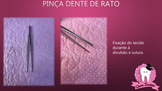 Fixação do tecido
durante à
divulsão e sutura
 