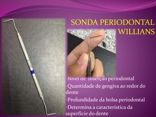 •Nível de inserção periodontal
•Quantidade de gengiva ao redor do
dente
•Profundidade da bolsa periodontal
•Determina a característica da
superfície do dente
SONDA PERIODONTAL
WILLIANS
 