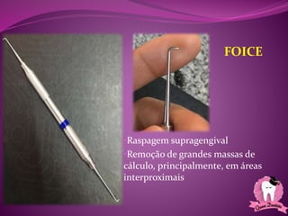 •Raspagem supragengival
•Remoção de grandes massas de
cálculo, principalmente, em áreas
interproximais
FOICE
 