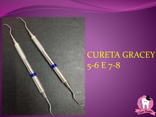 CURETA GRACEY
5-6 E 7-8
 