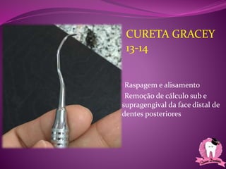 •Raspagem e alisamento
•Remoção de cálculo sub e
supragengival da face distal de
dentes posteriores
CURETA GRACEY
13-14
 