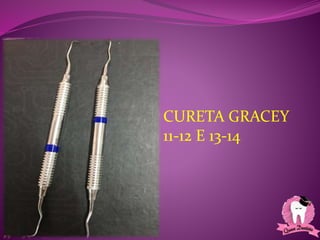 CURETA GRACEY
11-12 E 13-14
 