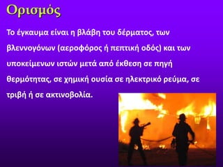 Ορισμός
Το έγκαυμα είναι η βλάβη του δέρματος, των
βλεννογόνων (αεροφόρος ή πεπτική οδός) και των
υποκείμενων ιστών μετά από έκθεση σε πηγή
θερμότητας, σε χημική ουσία σε ηλεκτρικό ρεύμα, σε
τριβή ή σε ακτινοβολία.
 