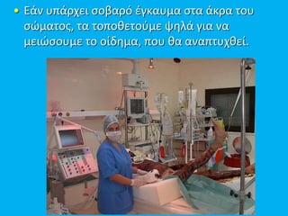• Εάν υπάρχει σοβαρό έγκαυμα στα άκρα του
σώματος, τα τοποθετούμε ψηλά για να
μειώσουμε το οίδημα, που θα αναπτυχθεί.
 