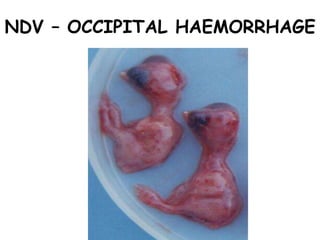 NDV – OCCIPITAL HAEMORRHAGE
 