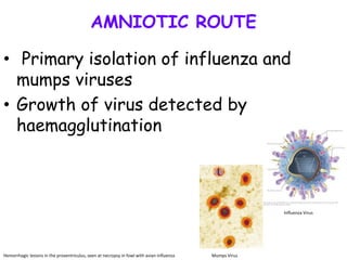 AMNIOTIC ROUTE
• Primary isolation of influenza and
mumps viruses
• Growth of virus detected by
haemagglutination
Hemorrhagic lesions in the proventriculus, seen at necropsy in fowl with avian influenza
Influenza Virus
Mumps Virus
 