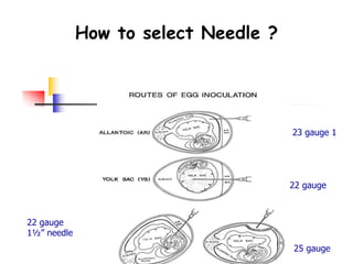 How to select Needle ?
25 23 gauge 1
2222 gauge
25 gauge
22 gauge
1½” needle
 