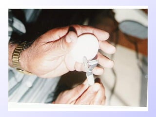 Ladle Inoculation Egg inoculation technique complete 1 | PPT
